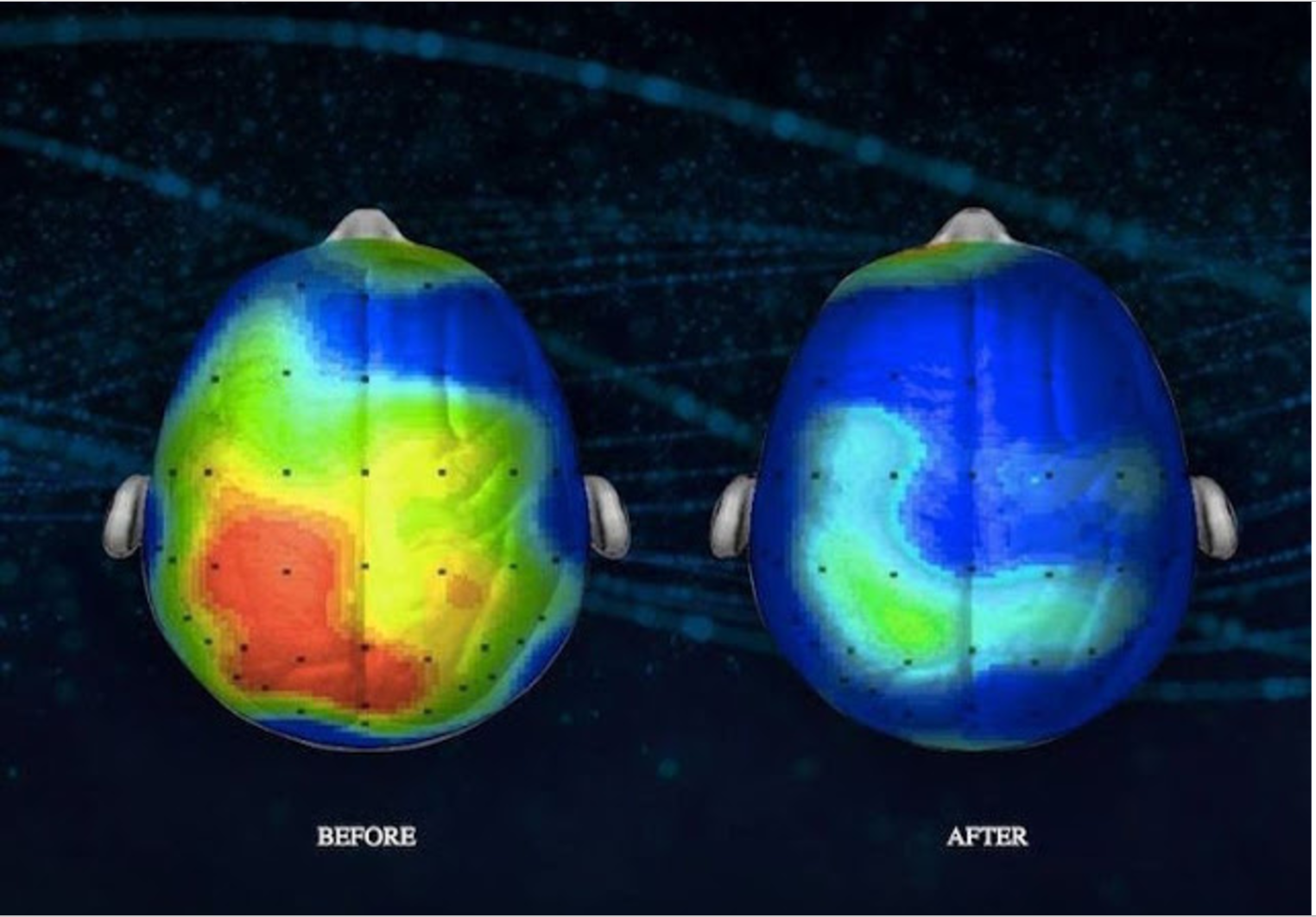 Neuroscientists Discover a Song That Reduces Anxiety By 65 Percent (Listen)