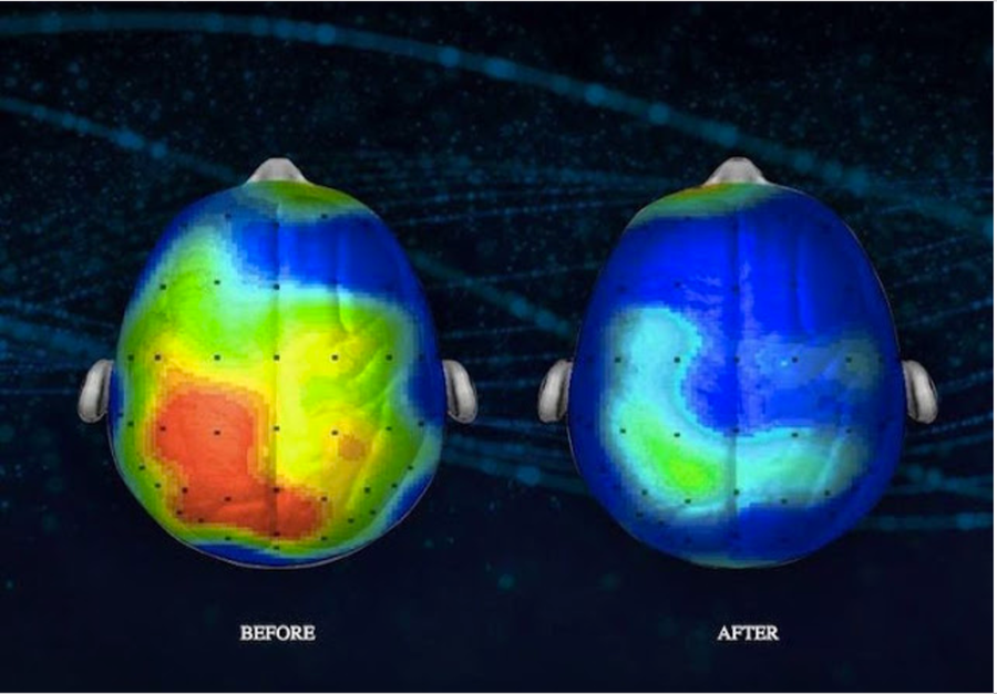 Neuroscientists Discover a Song That Reduces Anxiety By 65 Percent (Listen)